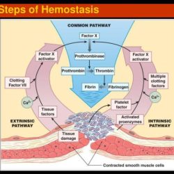 Concept map steps of hemostasis